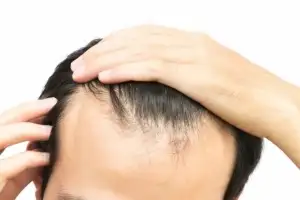 “머리숱 풍성하다더니 가발”…탈모 숨긴 남편 고소한 인도女