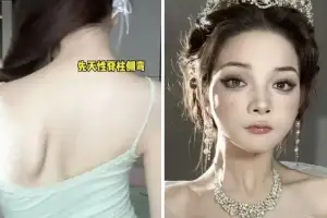 8천만원 빚 갚았더니 “너 가짜지?” 비난…中 인플루언서 ‘뇌성마비 위장’ 논란