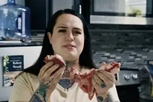 “피 많을수록 좋아” 매일 900g ‘생고기’ 먹는 28세女… ‘이 문제’ 충격 결과