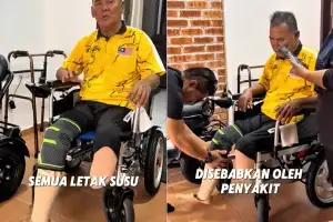 thumbnail - “탄산음료에 ‘한 스푼’ 넣다…두 다리 절단했다” 말레이시아 남성, 대체 뭐길래