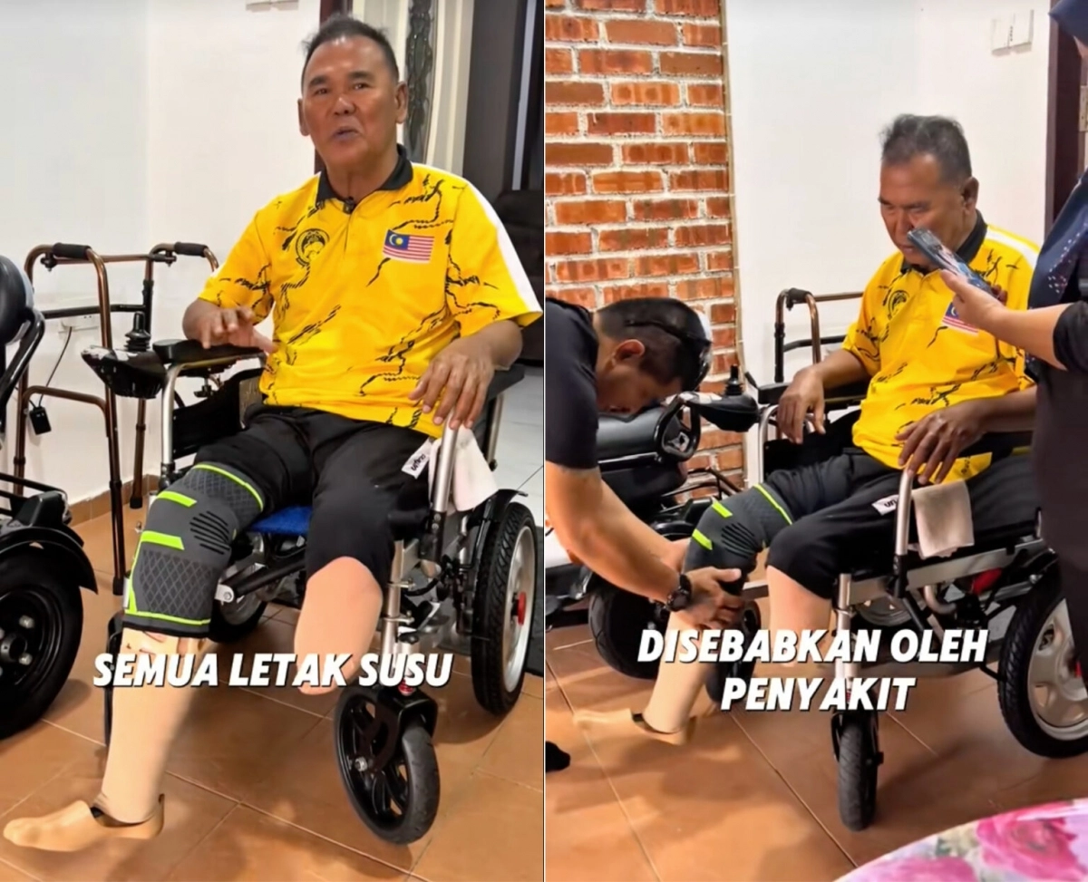 말레이시아의 사회적 기업 ‘케디디’가 공식 소셜미디어(SNS)를 통해 당뇨병 합병증으로 두 다리를 절단한 남성의 이야기를 소개했다. 자료 : 케디디 공식 틱톡