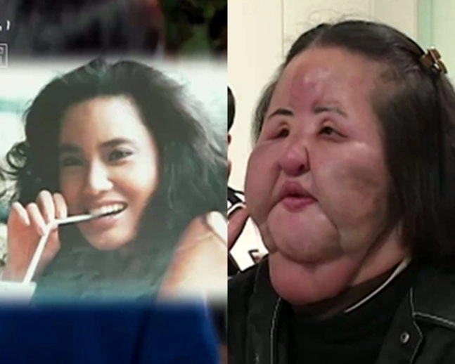 SBS ‘꼬리에 꼬리를 무는 그날 이야기’ 방송화면 캡처