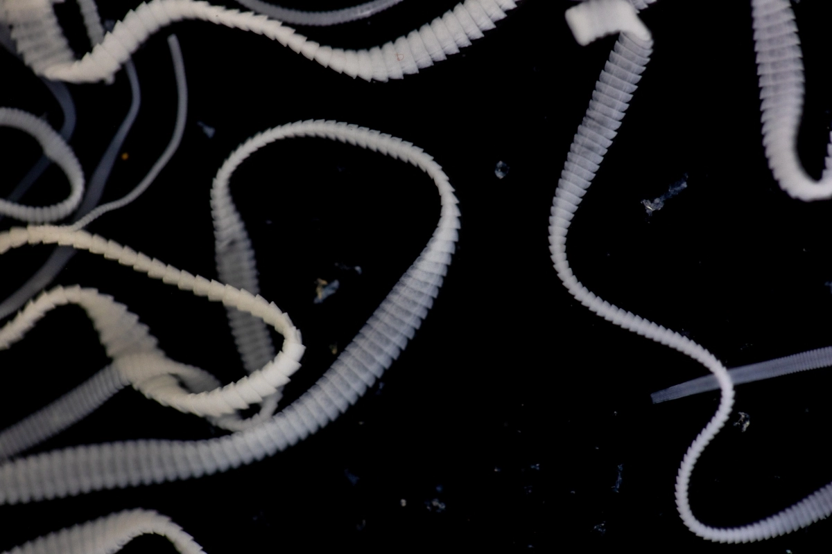 촌충 사진. 123rf