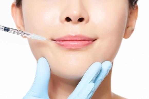 성형·시술 자료 이미지. 사진은 기사 내용과 무관함. 아이클릭아트