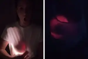 수술한 가슴 보형물에 ‘야광’ 기능이?…“어둠 속 브랜드 로고까지 다 보여”