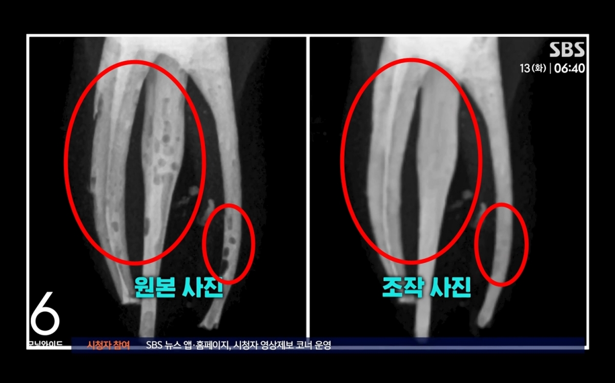 연세대학교 치과대학 학생들이 실습 결과물을 포토샵으로 조작하거나 서로의 과제를 베껴 제출하는 등 집단 부정행위를 저질러 징계를 받은 사실이 알려졌다. 사진은 13일 SBS가 공개한 조작 전후 과제 사진. 2026.1.13 SBS 화면