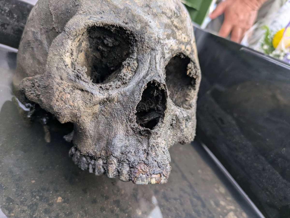 일본 야마구치현 우베시에 있는 조세이 탄광에서 수습된 희생자의 유골. 조덕호 대구대 명예교수 제공