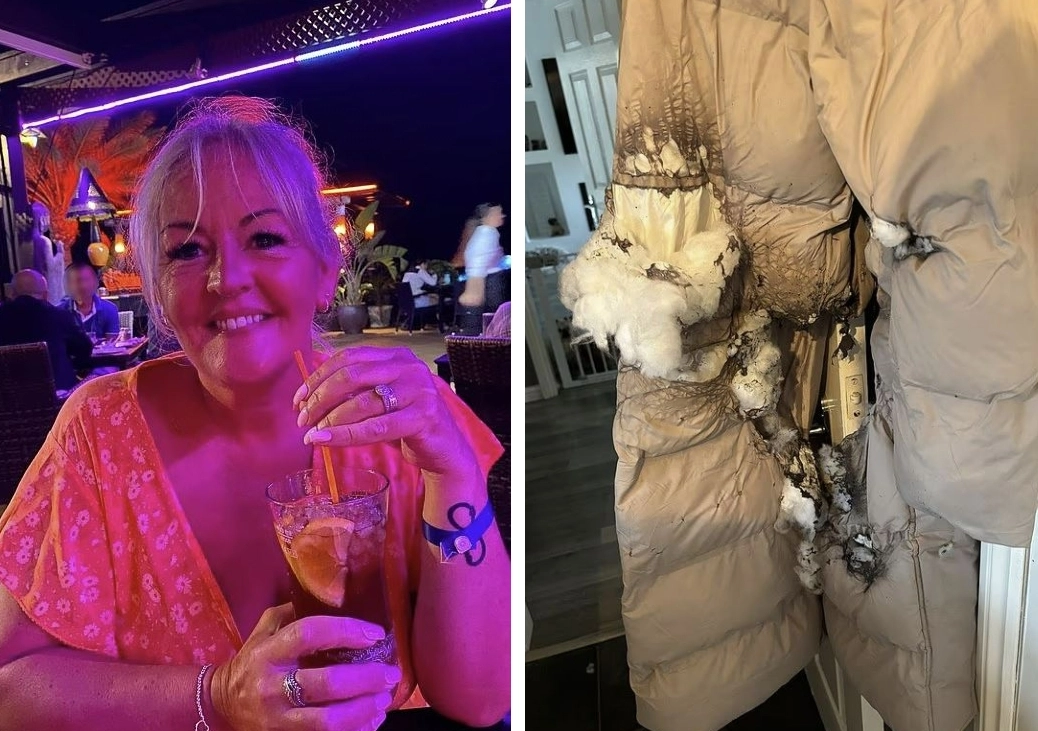 전자담배 폭발로 다리에 심한 화상을 입은 케리 로버츠(52)씨와 폭발 당시 입고 있던 코트. 데일리메일 캡처