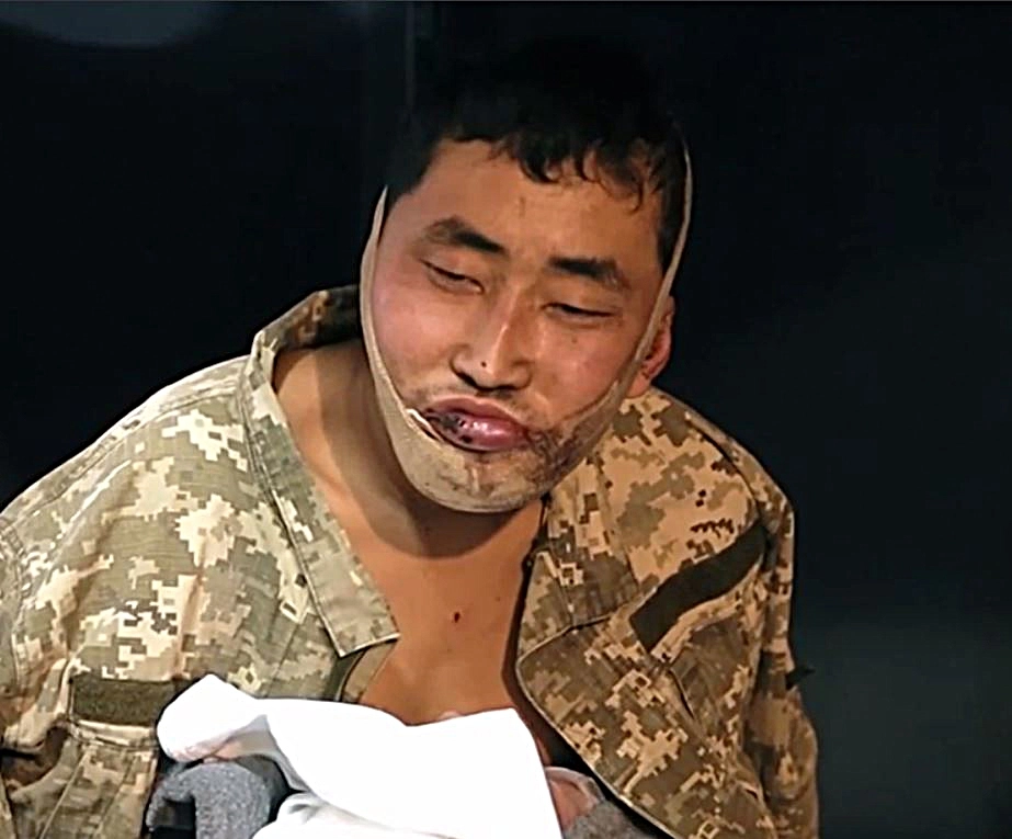 러시아 쿠르스크 지역에서 교전 중 생포된 북한군 2명이 우크라이나 키이우 내 포로수용시설 침대에서 한국어로 심문을 받는 영상이 12일(현지시간) 공개됐다. 1999년생으로 2016년부터 복무한 저격 정찰 장교는 턱에 붕대를 감은 채 앉아 있다. 우크라이나 보안국(SBU) 캡처