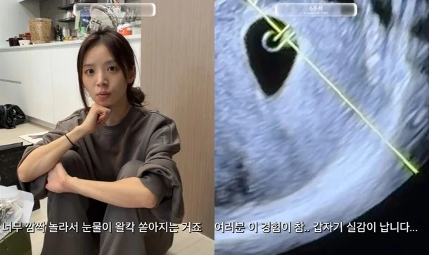 김지영 유튜브 캡처