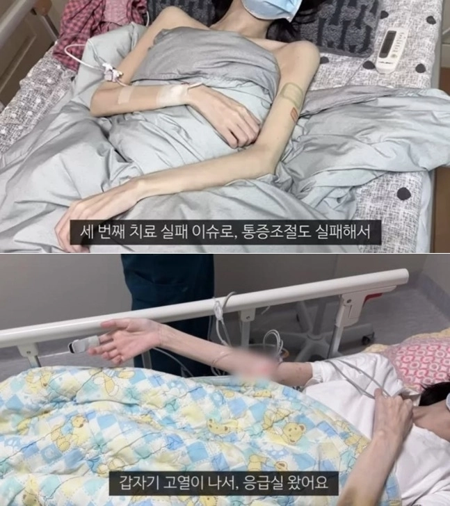 유튜브를 통해 암 투병의 시간을 기록해 온 유튜버 유병장수걸(유병장수girl)이 28세 나이로 세상을 떠났다. 유튜브 채널 ‘유병장수girl’ 캡처