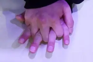 “쓰러진 여성, 돕기 망설여져”…속옷 벗기지 말고 ‘이렇게’ 하세요