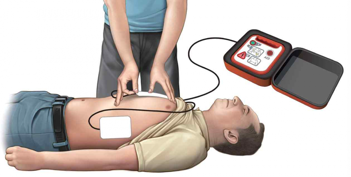 질병관리청과 대한심폐소생협회는 29일 ‘2025 개정 한국 심폐소생술 가이드라인’을 발표했다. 여성 심장정지 환자의 경우 속옷(브래지어)을 제거하지 않고 위치를 조정한 뒤에 가슴 조직을 피해 충격기 패드를 맨 가슴에 부착하도록 권고했다. 속옷을 옆으로 젖힌 다음 오른쪽 쇄골 뼈와 유두 사이, 왼쪽 옆구리 쪽에 각각 패드를 붙이면 된다. 질병관리청 제공