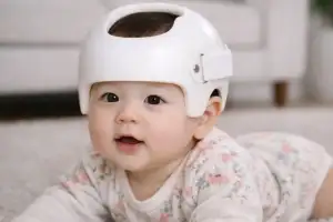 “예쁜 두상 위해” 300만원짜리 ‘헬멧’이 유행?…의사들은 ‘만류’, 왜