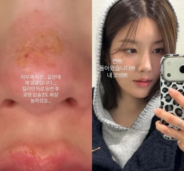 사진=권은비 인스타그램 캡처