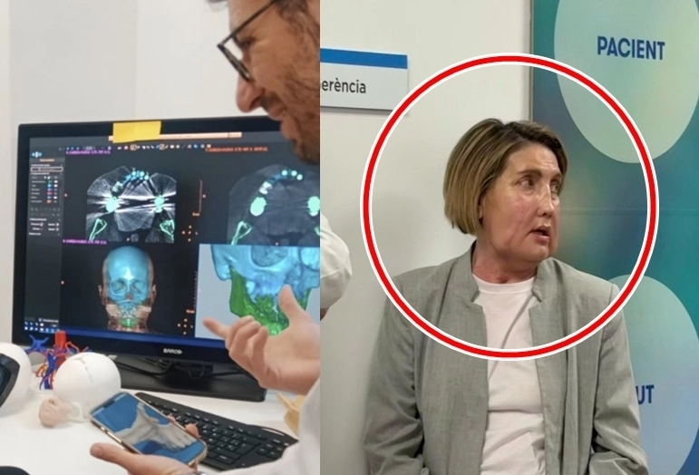 스페인 바르셀로나 발 데브론 병원이 바이러스 감염에 의한 괴사로 얼굴이 심하게 손상된 40대 여성에게 조력 사망으로 숨진 여성의 얼굴을 이식하는 데 성공했다. 자료 : 스페인 바르셀로나 발 데브론 병원 홈페이지