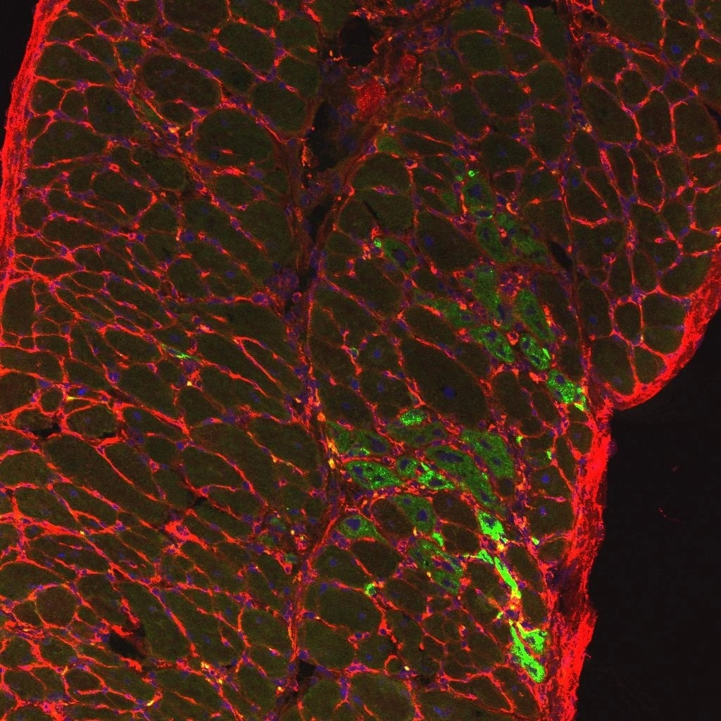 (사진=듀센근이영양증 근육 조직 현미경)