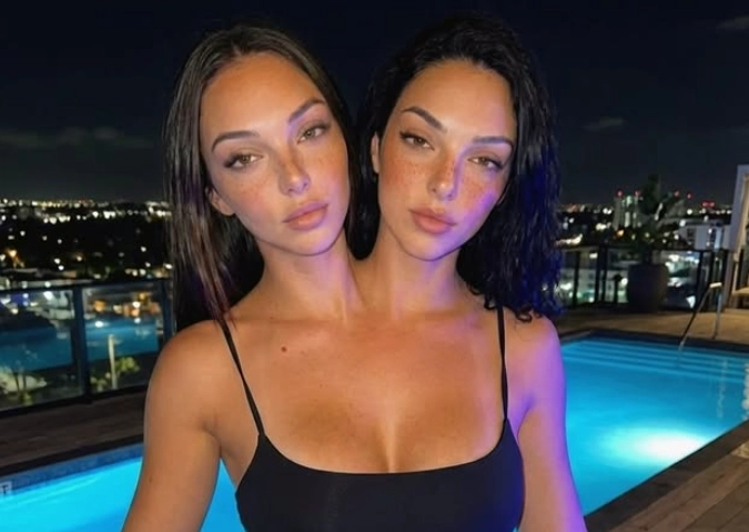 소셜미디어(SNS)에서 수십만명의 팔로워를 모으며 화제가 된 샴쌍둥이 모델이 인공지능(AI)으로 생성됐다는 사실이 알려지자 윤리적 논란이 일고 있다. 인스타그램 캡처