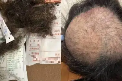 “집 앞 식당 끔찍한 악취” 머리카락 쥐어뜯었다…극심 고통 호소한 대만 주민들