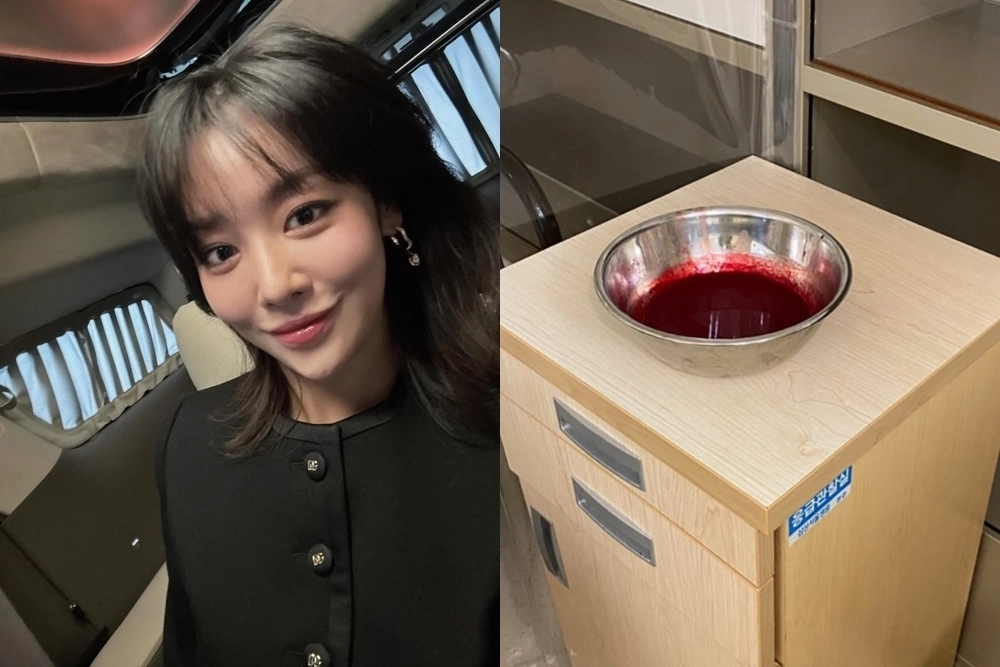 배우 차주영이 ‘반복적 비출혈’ 치료를 위한 수술로 활동을 중단한 가운데 5년 전에 겪었던 증상을 공개했다. 차주영 인스타그램