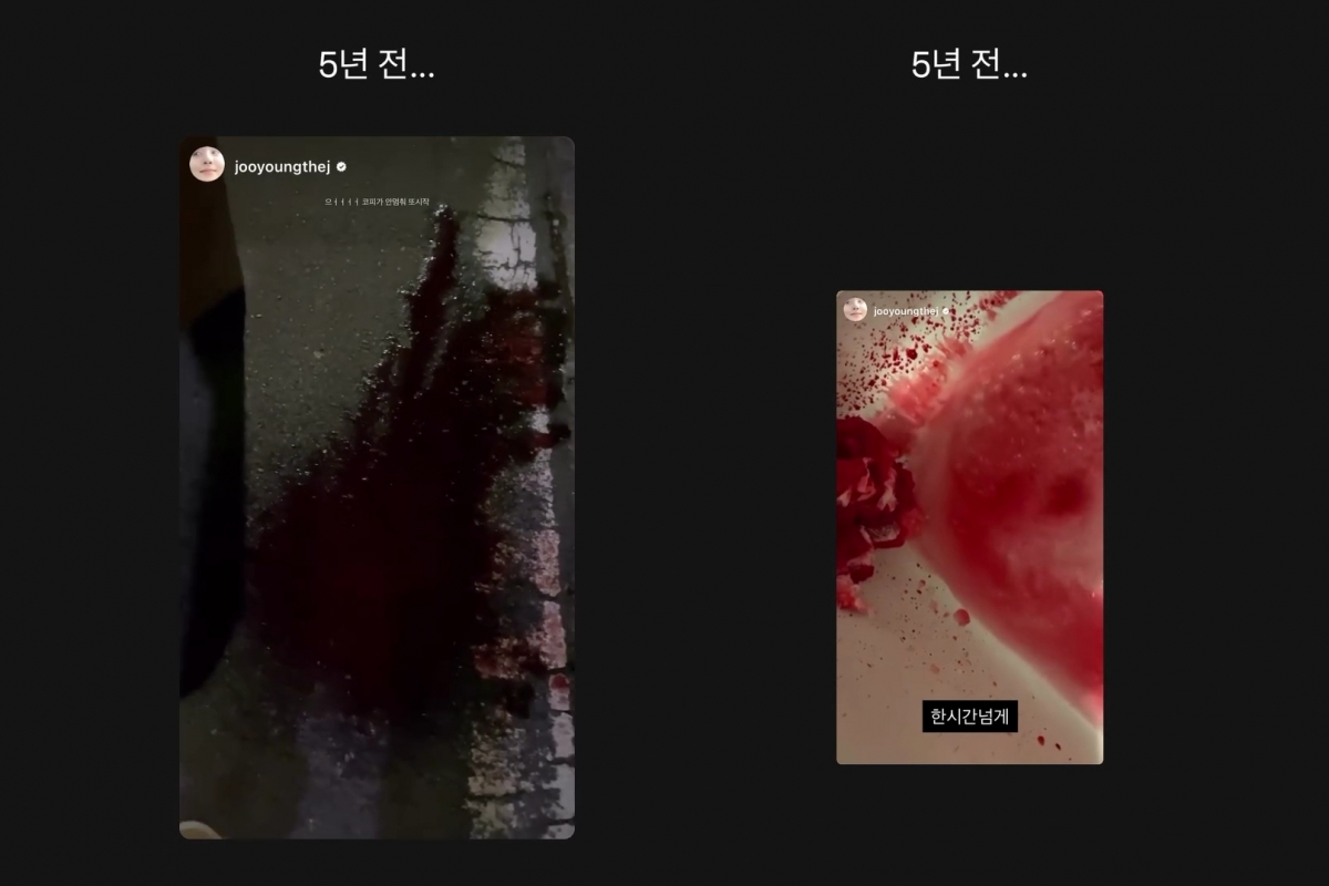 배우 차주영이 ‘반복적 비출혈’ 치료를 위한 수술로 활동을 중단한 가운데 5년 전에 겪었던 증상을 공개했다. 차주영 인스타그램