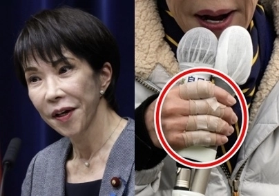 다카이치 사나에(왼쪽) 일본 총리. 다카이치 총리는 지난 7일 도쿄에서 열린 집권 자민당의 중의원 선거유세에서 오른손 손가락에 붕대를 감은 채 마이크를 잡고 연설했다. AP 연합뉴스