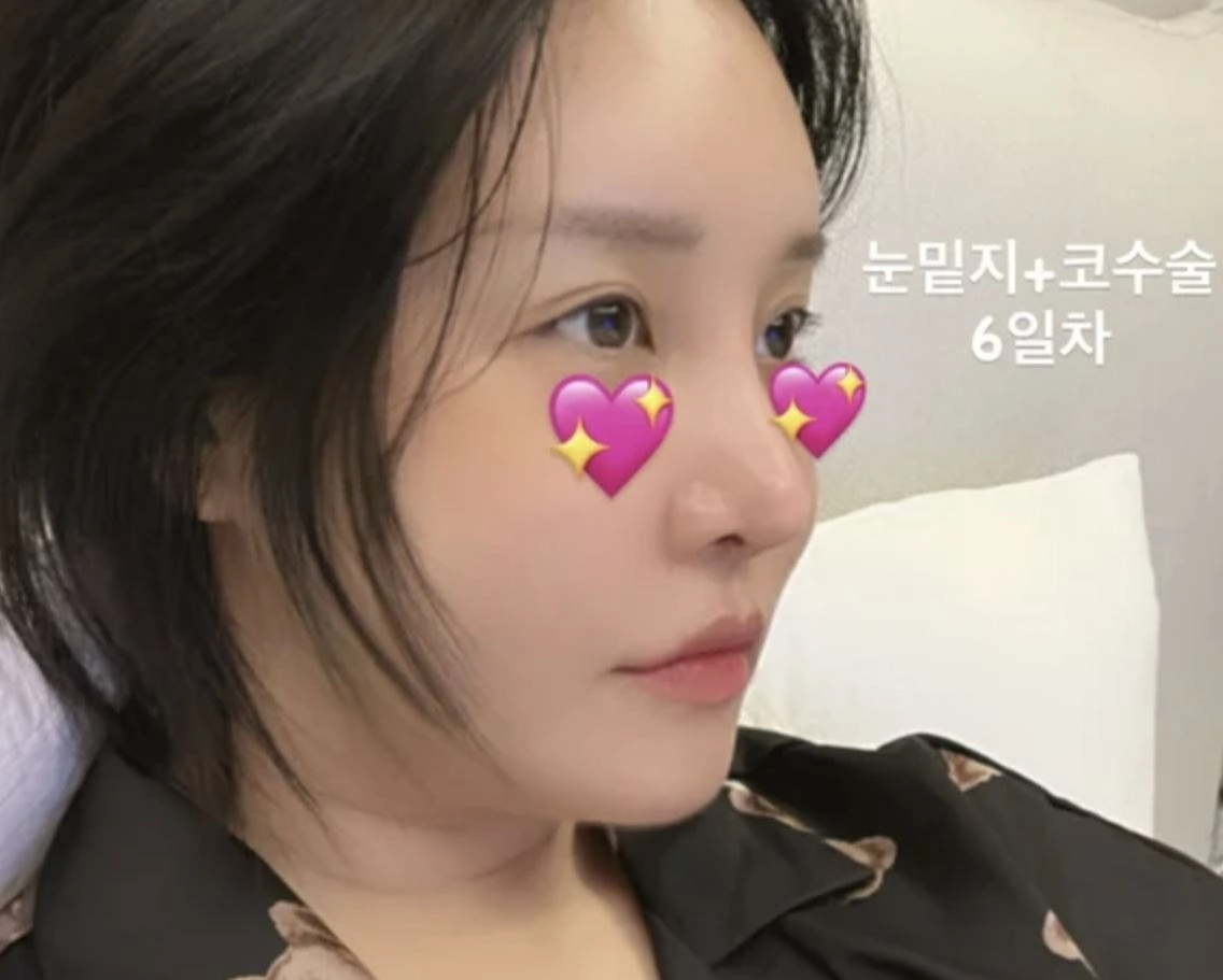 랄랄 인스타그램