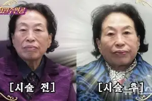 87세 전원주, 피부시술에 500만원 쓰더니 “60대 얼굴”