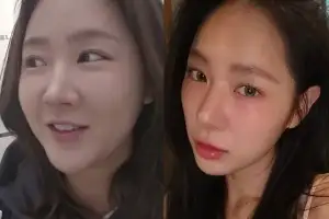 ‘성형설’ 소유 “20㎏ 빠져 얼굴형 변한 것”…과거 사진 비교해 보니