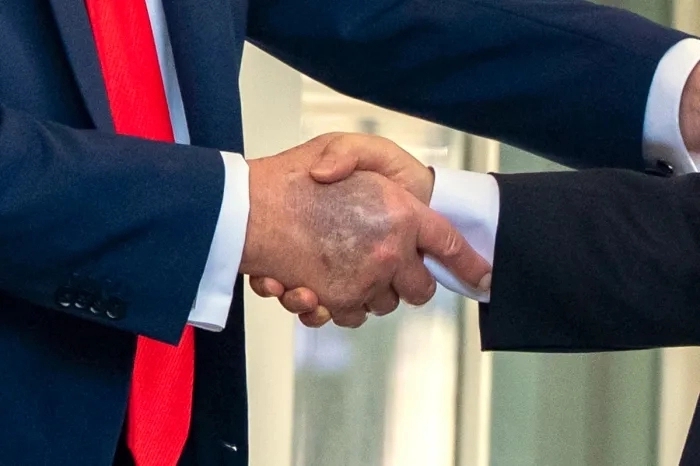 이재명 대통령과 악수하는 도널드 트럼프 대통령의 손이 멍들어있다. AP연합뉴스