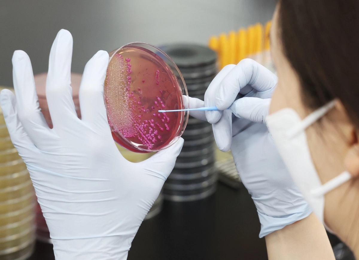 보건환경연구원이 식중독균 배양분리작업을 하는 모습. 기사와 관련 없는 자료 사진. 연합뉴스