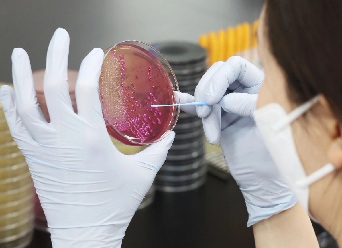 보건환경연구원들이 식중독균 배양분리작업을 하고 있다. 기사와 관련 없는 자료 사진. 연합뉴스