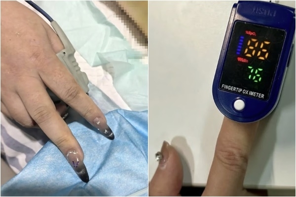 중국의 20대 여성이 급성 심장마비로 병원에 이송됐으나 화려하게 장식한 ‘젤 네일’ 때문에 적절한 응급 처치를 받지 못할 뻔한 사건이 발생했다. SCMP 캡처(본인 제공)