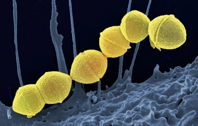 A형 연쇄상구균. 미국 국립보건원(NIH)