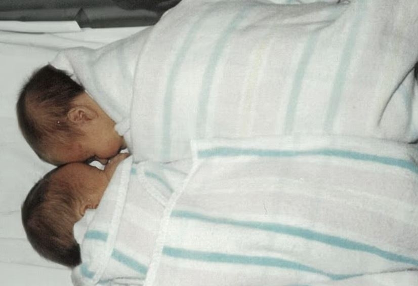 1995년 시험관 시술로 태어난 페니 샤프란스키의 쌍둥이 딸. 30년 후 유전자 검사에서 병원이 타인의 수정란을 잘못 이식했다는 사실이 밝혀졌다. 데일리메일 캡처