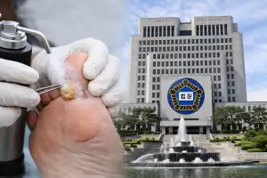 티눈 수술 2500번에 7억 보험금…보험사 또 졌다
