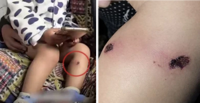 이스라엘군이 팔레스타인 남성의 자백을 강요하는 과정에서 생후 18개월 된 아기를 고문했다는 주장이 제기됐다. 팔레스타인 TV, 알자지라 방송 캡처