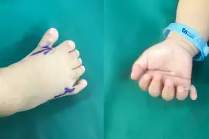 “손가락·발가락 합쳐 26개” 아기 모습에 ‘충격’…원인 뭐길래?