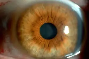 thumbnail - 돼지 정액이 난치성 암 치료에 특효?