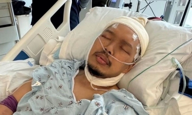 코미디언 겸 배우 故 알렉스 듀옹. SNS 캡처