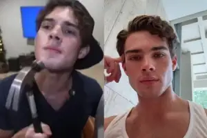 “남자다운 턱 만드는 법?” 망치로 ‘쾅쾅’…MZ세대서 확산하는 ‘이것’