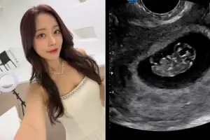 thumbnail - ‘5세 연상♥’과 결혼 3년여만 “저 임신했어요”… 38세 유명 여배우 깜짝 발표