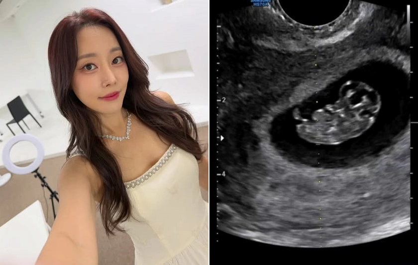 고우리 인스타그램 캡처