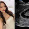 ‘5세 연상♥’과 결혼 3년여만 “저 임신했어요”… 38세 유명 여배우 깜짝 발표