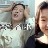 이지혜, ‘인중축소술’ 했는데 어쩌나…안타까운 소식