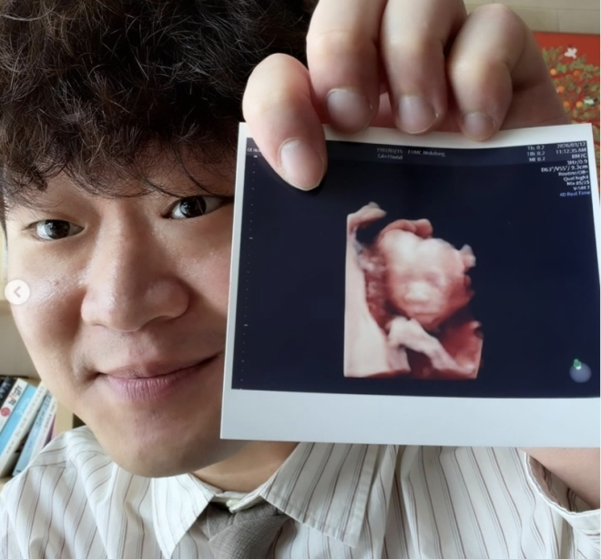 “아이가 생겼습니다”…정재형, 아들 사진 공개