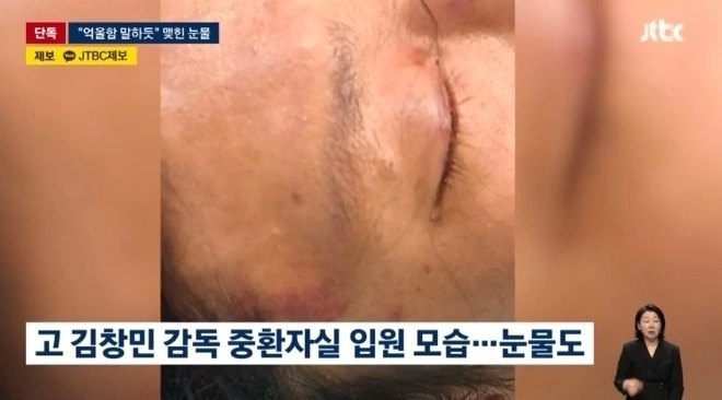 식당에서 무차별 폭행을 당한 끝에 사망한 고(故) 김창민 영화감독이 응급실에 실려갔을 당시의 사진이 공개됐다. JTBC 뉴스 캡처