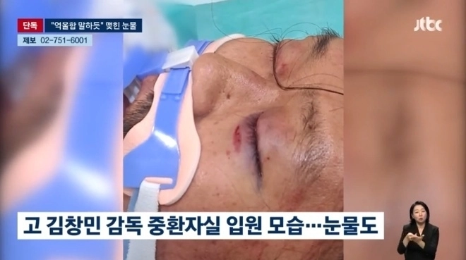 식당에서 무차별 폭행을 당한 끝에 사망한 고(故) 김창민 영화감독이 응급실에 실려갔을 당시의 사진이 공개됐다. JTBC 뉴스 캡처