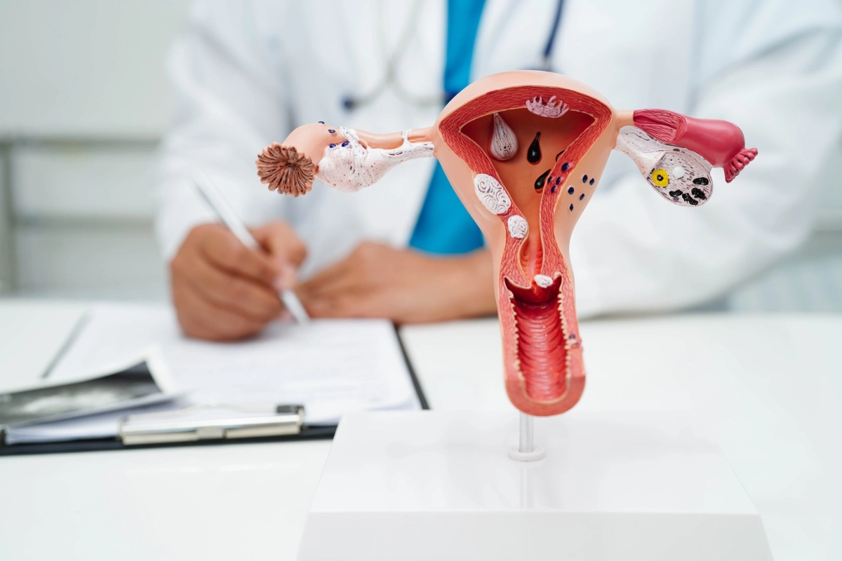 여성 자궁 모형. 123RF