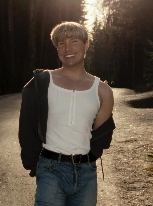 조니 헤셀그렌의 시술 전 모습. 인스타그램(@hesselgrenjoni) 캡처